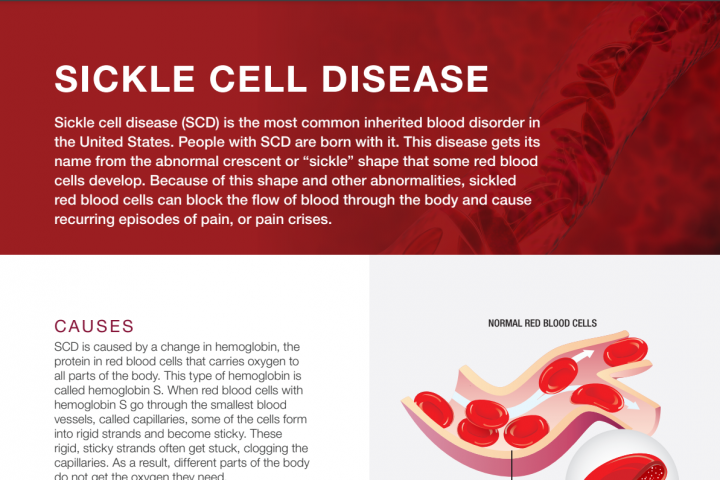 Sickle Cell Disease - What Is Sickle Cell Disease? | NHLBI, NIH